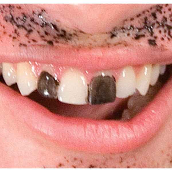 Black Temp Tooth Color