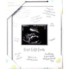 Photo Frame - Sonogram